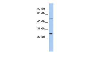 ctrb1 antibody, n-term