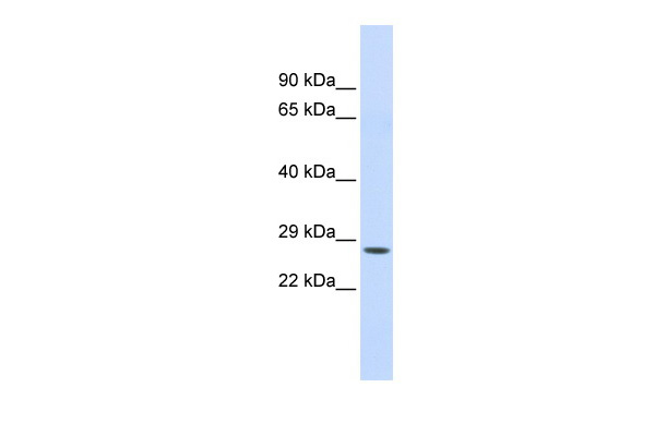 ctrc antibody - n-terminal region (arp33873_p050) in human liver using western blot